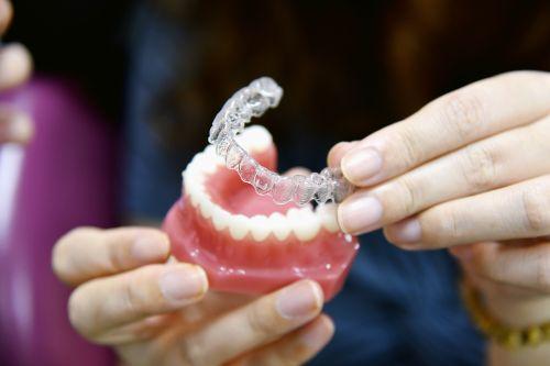 A woman holding a mould of teeth with clear aligners for illustration in Columbia, Md
